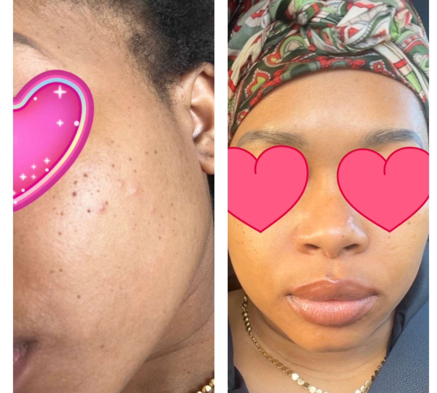 Tumeric skincare set